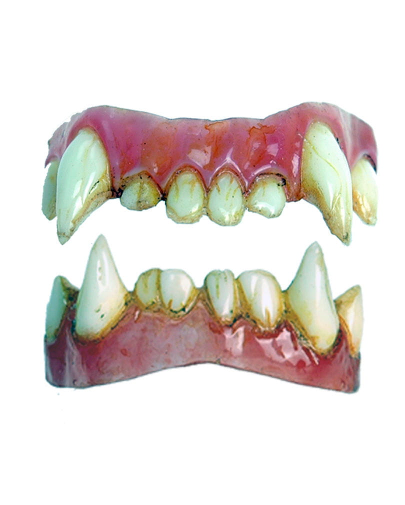 Bild von Dental FX Veneers Werwolf-Zähne