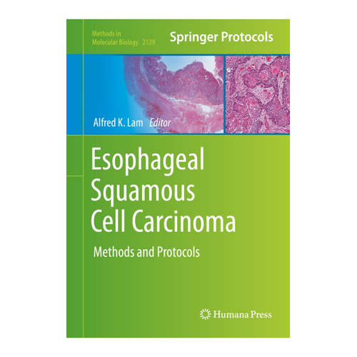 Bild von Esophageal Squamous Cell Carcinoma: Methoden und Protokolle