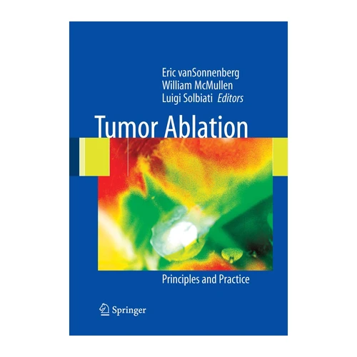 Bild von Tumor Ablation: Principles and Practice, Tumor Ablation