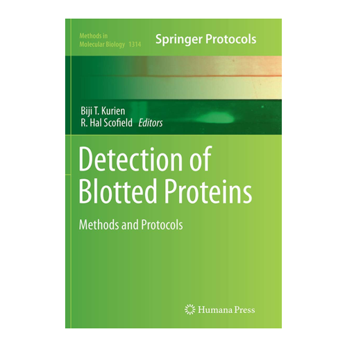 Bild von Detection of Blotted Proteins: Methoden und Protokolle