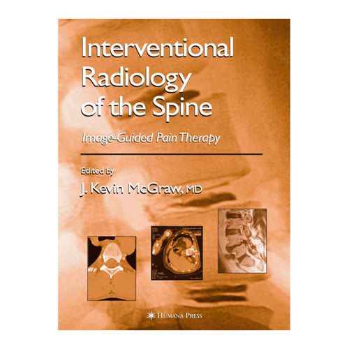 Bild von Interventional Radiology of the Spine: Image-Guided Pain Therapy - Ein umfassender Leitfaden