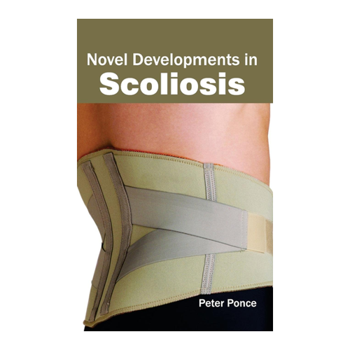 Bild von Novel Developments in Scoliosis – Ein umfassender Leitfaden