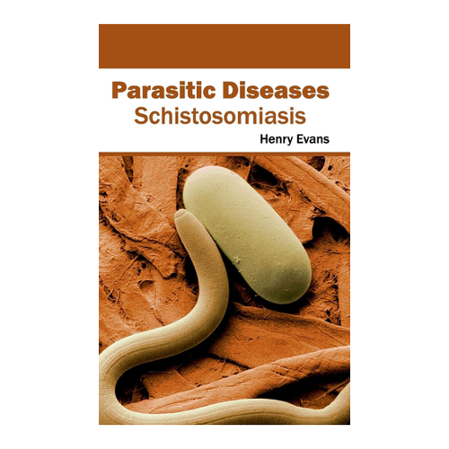 Bild von Parasitic Diseases: Schistosomiasis – Ein umfassender Überblick