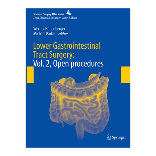 Bild von Lower Gastrointestinal Tract Surgery: Vol. 2, Open Procedures