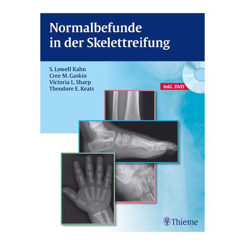 Bild von Normalbefunde in der Skelettreifung von S. Lowell Kahn