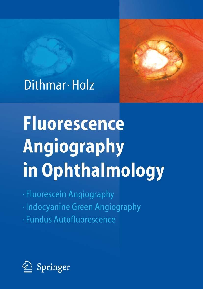 Bild von Fluorescence Angiography in Ophthalmology: Fluorescein Angiography, Indocyanine Green Angiography, Fundus Autofluorescence
