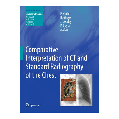 Bild von Comparative Interpretation of CT and Standard Radiography of the Chest