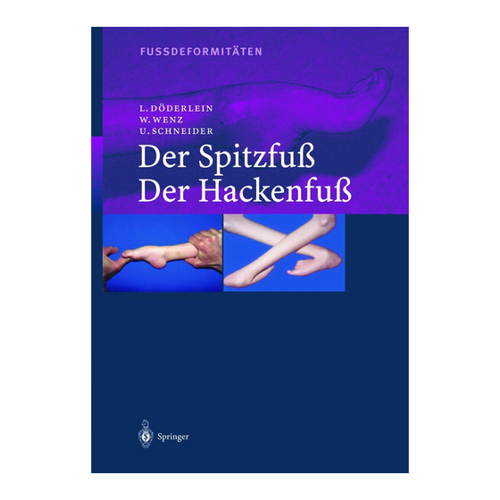 Bild von Fussdeformitäten: Der Spitzfuss/Der Hackenfuss von Leonhard Döderlein