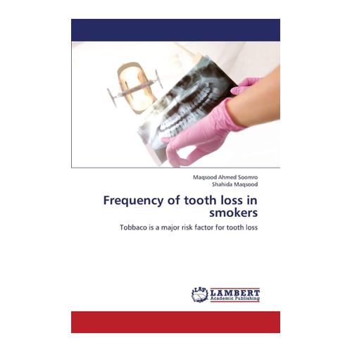 Bild von Frequency of Tooth Loss in Smokers von Maqsood Ahmed Soomro