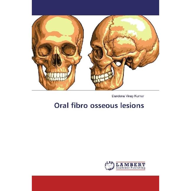 Bild von Oral fibro osseous lesions, Fachbücher von Dandena Vinay Kumar