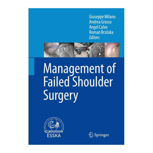 Bild von Management of Failed Shoulder Surgery