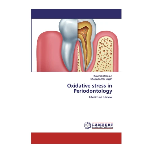Bild von Oxidative Stress in der Parodontologie