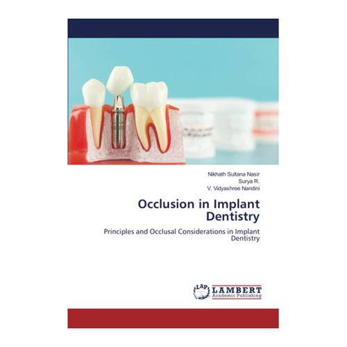 Bild von Occlusion in Implant Dentistry