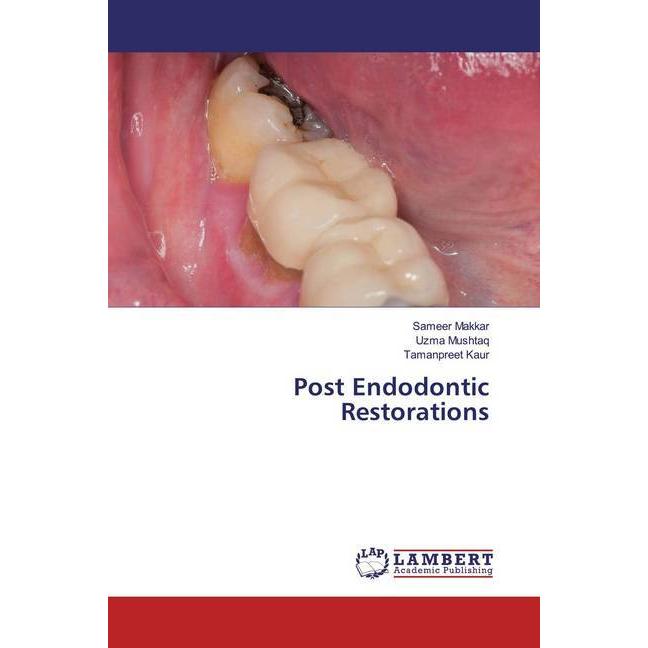 Bild von Post Endodontic Restorations, Fachbücher von Sameer Makkar, Uzma Mushtaq, Tamanpreet Kaur
