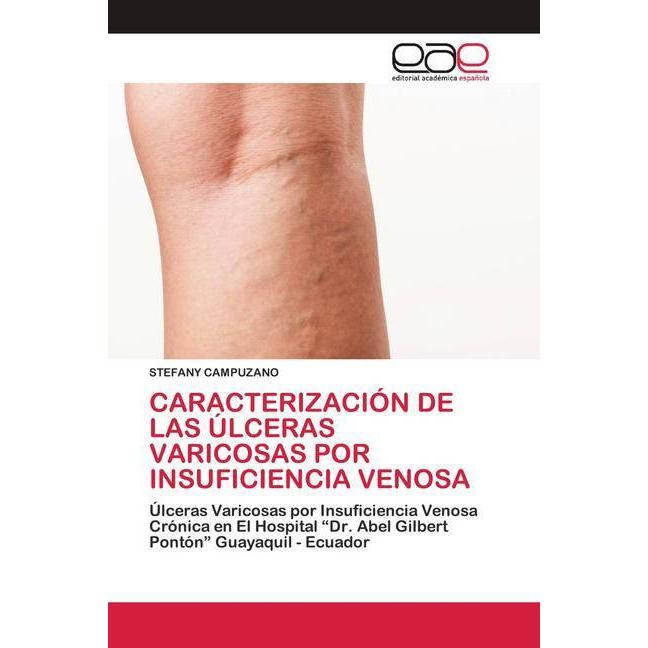 Bild von Caracterización De Las úlceras Varicosas Por Insuficiencia Venosa, Fachbücher von STEFANY CAMPUZANO