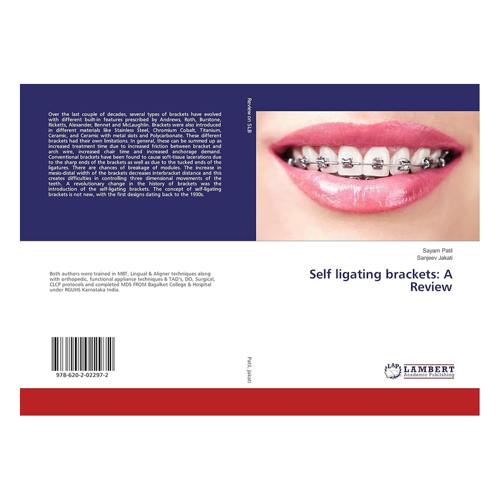 Bild von Selbstligierende Brackets: Eine umfassende Betrachtung