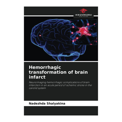 Bild von Hemorrhagic transformation of brain infarct: Eine tiefgehende Analyse