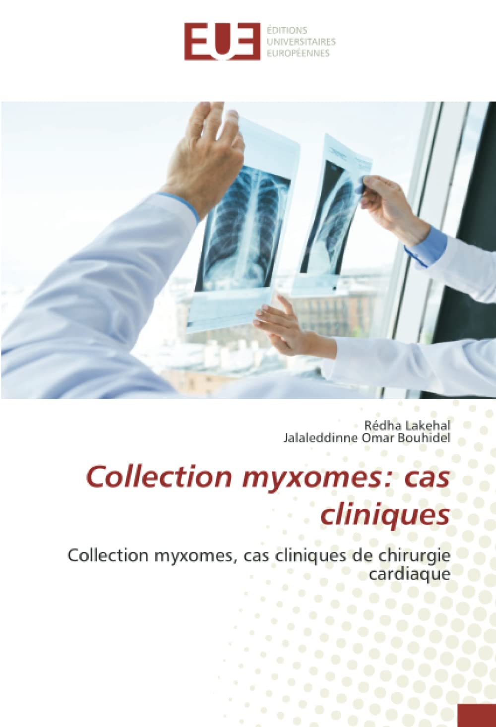 Bild von Collection myxomes: cas cliniques: Collection myxomes, cas cliniques de chirurgie cardiaque