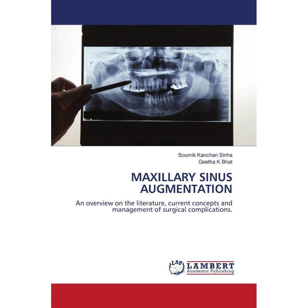 Bild von Maxillary Sinus Augmentation, Fachbücher von Soumik Kanchan Sinha, Geetha K Bhat