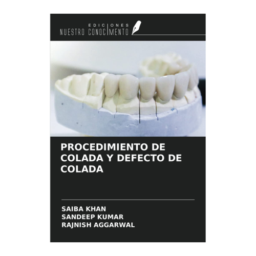 Bild von Khan, Saiba: PROCEDIMIENTO DE COLADA Y DEFECTO DE COLADA - Produktcheck