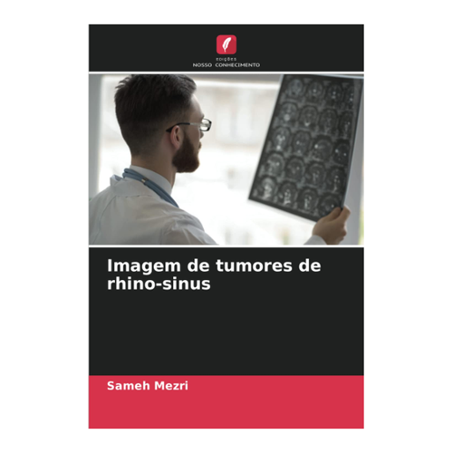 Bild von Imagem de Tumores de Rhino-Sinus – Eine eingehende Untersuchung