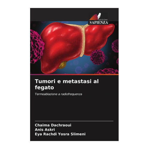 Bild von Dachraoui, Chaima: Tumori e metastasi al fegato – Termoablazione a radiofrequenza