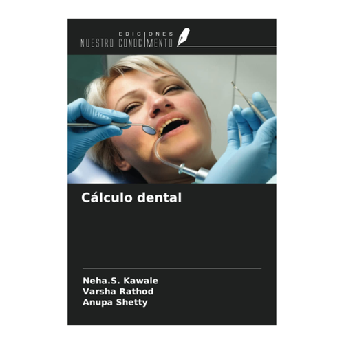 Bild von Cálculo dental - Dr. Neha S. Kawale