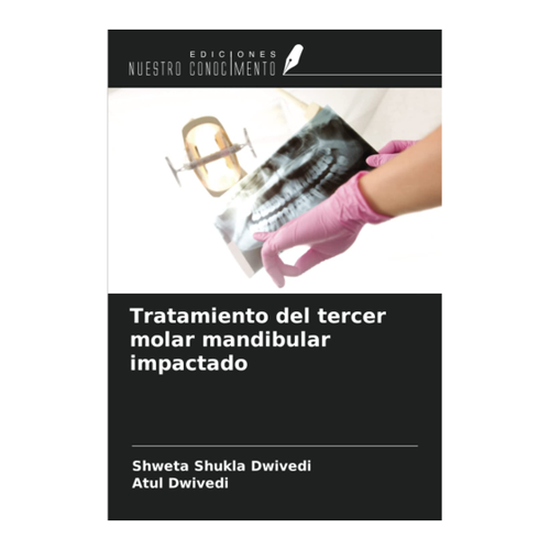 Bild von Tratamiento del tercer molar mandibular impactado – Eine umfassende Analyse