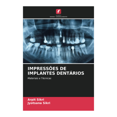 Bild von Sikri, Arpit: IMPRESSÕES DE IMPLANTES DENTÁRIOS