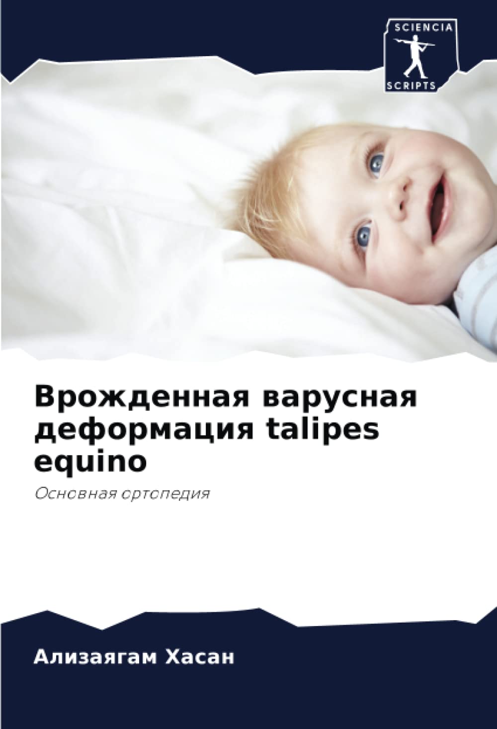 Bild von Врожденная варусная деформация talipes equino: Основная ортопедия: Osnownaq ortopediq