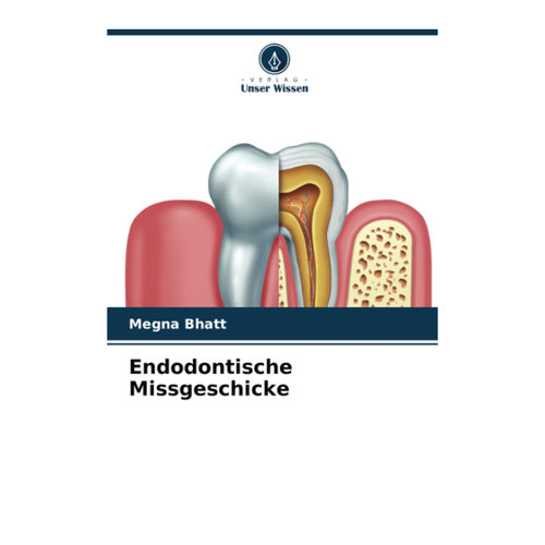Bild von Endodontische Missgeschicke: DE