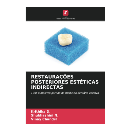 Bild von D., Krithika: RESTAURAÇÕES POSTERIORES ESTÉTICAS INDIRECTAS