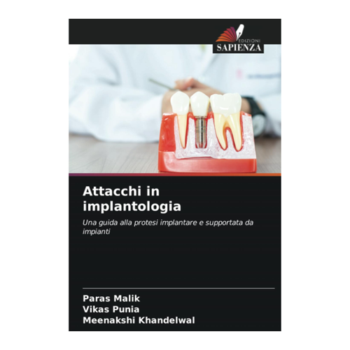 Bild von Attacchi in implantologia: Eine umfassende Anleitung zur implantatgestützten Prothetik
