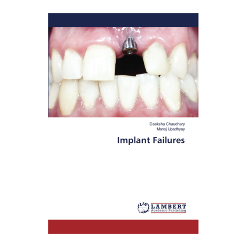 Bild von Implant Failures von Deeksha Chaudhary