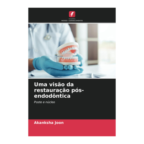 Bild von Joon, Akanksha: Uma visão da restauração pós-endodôntica