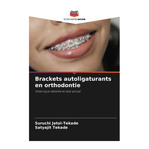 Bild von Brackets autoligaturants en orthodontie: Historique détaillé et état actuel