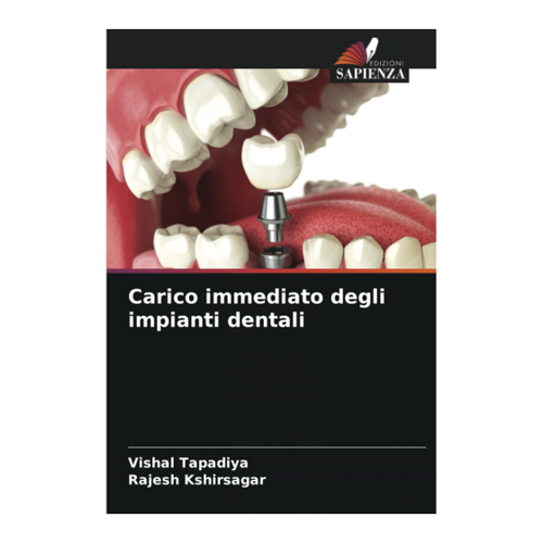 Bild von Carico immediato degli impianti dentali von Dr. Vishal Tapadiya